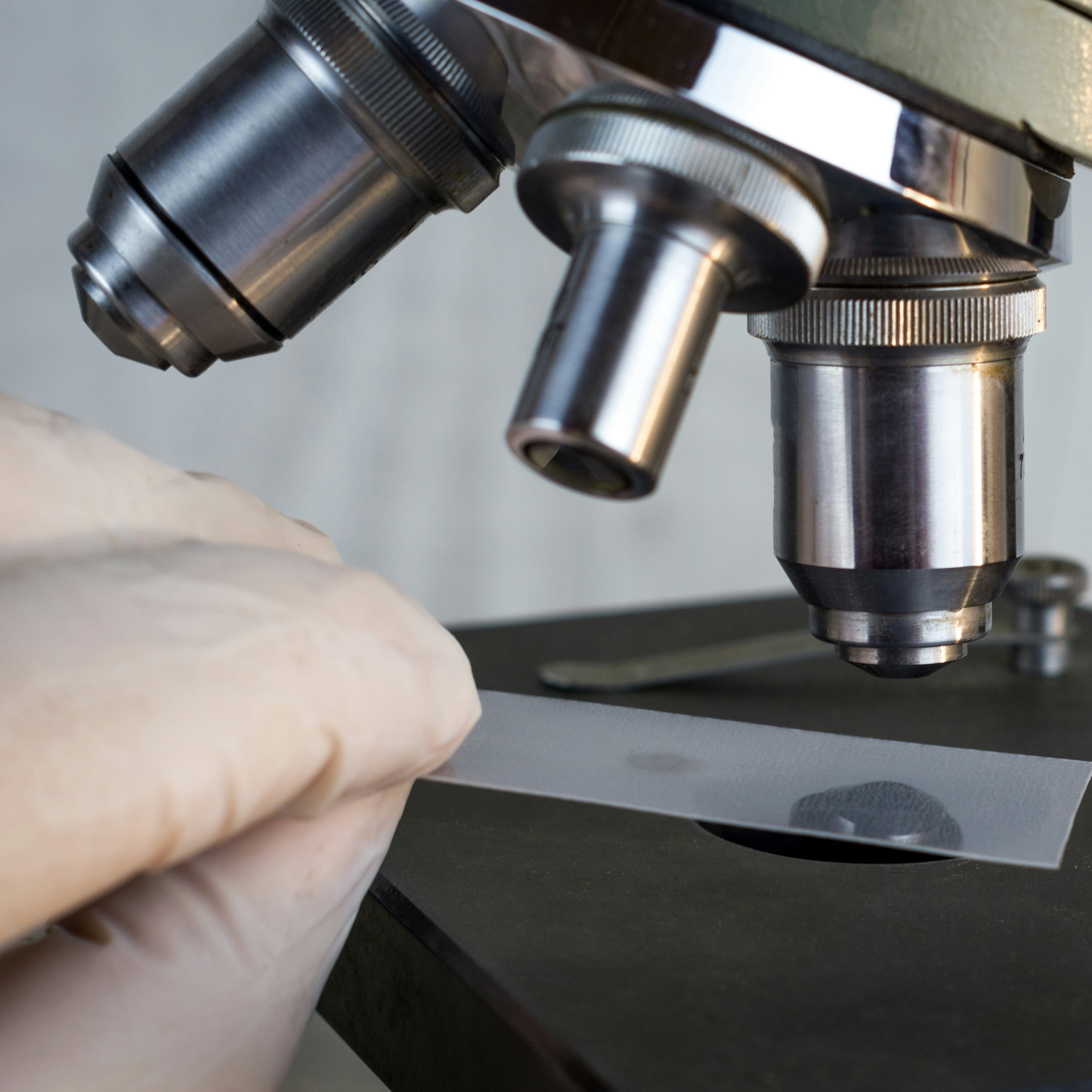 photo of a microscope slide being examined